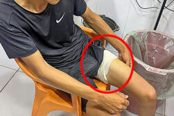 En ronda de amigos manipulaban un arma de fuego y recibió un balazo en el muslo.