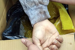 Sufrió la amputación del brazo en grave accidente en una fábrica de Hernandarias