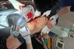 Joven es atacado a tiros y terminó herido