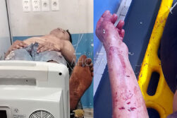 Mujer es víctima de intento de feminicidio en Pdte. Franco