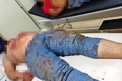 Dos fallecidos tras caída de motocicleta en Minga Porã