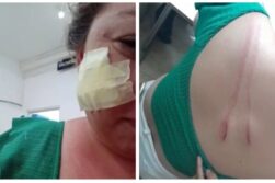 Le cortó el rostro porque rechazó bailar con él en carrera de caballos