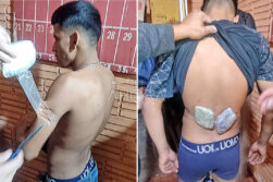 Intentó ingresar marihuana y cocaína pegados al cuerpo a la cárcel de Ciudad del Este