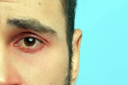 IPS advierte aumento de casos de ojo seco en invierno y recomienda medidas de prevención